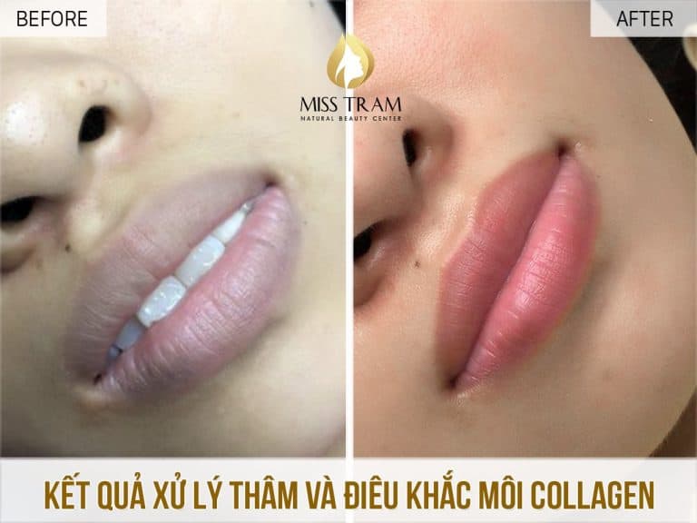 dkmcollagen hinh fb