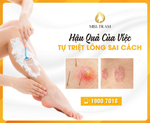 9 Sai Lầm Cần Tránh Xa Khi Tự Tẩy Lông Tại Nhà 51 Ngừng Ngay 9 Sai Lầm Này Nếu Bạn Tự Tẩy Lông Tại Nhà