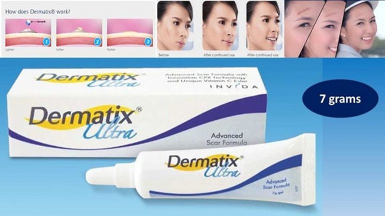 Kem trị sẹo lâu năm Dermatix Ultra: Giải pháp cho vết sẹo 9 review kem tri seo dermatix ultra co tot khong gia bao nhieu 28062019234326