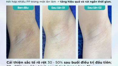 Photo of Địa Chỉ Trị Thâm Nách, Thâm Bẹn Uy Tín: Dr. Choice Clinic Có Tốt Không?
