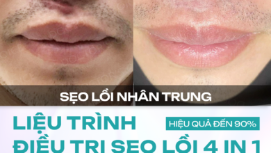 Photo of Hiệu quả điều trị sẹo lồi tại Dr. Choice Clinic như thế nào?